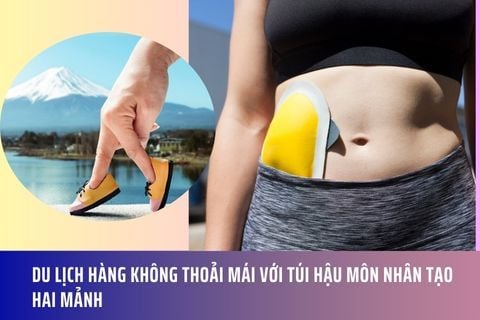 Du lịch hàng không thoải mái với túi hậu môn nhân tạo hai mảnh
