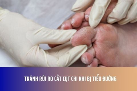 Tránh rủi ro cắt cụt chi khi bị tiểu đường