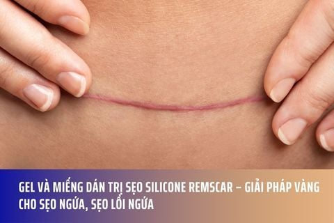 Gel và Miếng Dán Trị Sẹo Silicone Remscar – Giải Pháp Vàng Cho Sẹo Ngứa, Sẹo Lồi Ngứa