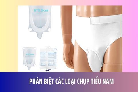 Phân biệt các loại chụp tiểu nam
