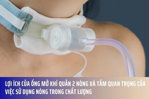Lợi ích của ống mở khí quản 2 nòng và tầm quan trọng của việc sử dụng nòng trong chất lượng