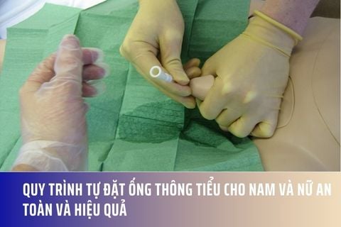Quy Trình Tự Đặt Ống Thông Tiểu Cho Nam Và Nữ An Toàn Và Hiệu Quả