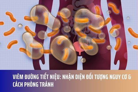 Viêm Đường Tiết Niệu: Nhận Diện Đối Tượng Nguy Cơ & Cách Phòng Tránh