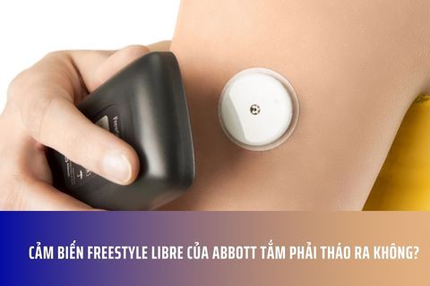 Cảm biến Freestyle Libre của Abbott tắm phải tháo ra không?