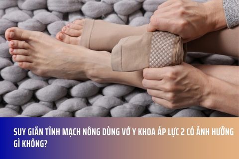 Suy giãn tĩnh mạch nông dùng vớ y khoa áp lực 2 có ảnh hưởng gì không?