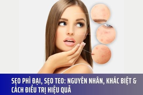 Sẹo Phì Đại và Sẹo Teo: Nguyên Nhân, Khác Biệt & Cách Điều Trị Hiệu Quả
