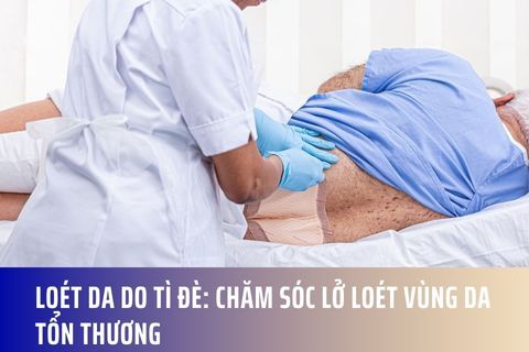 Loét da do tì đè: Chăm sóc lở loét vùng da tổn thương