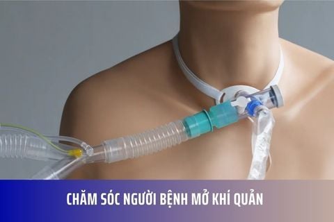 CHĂM SÓC NGƯỜI BỆNH MỞ KHÍ QUẢN - BẠN CẦN BIẾT