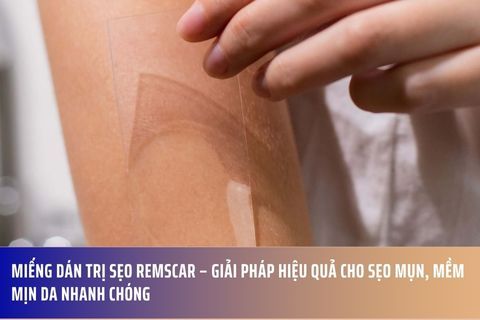 Miếng dán trị sẹo Remscar – Giải pháp hiệu quả cho sẹo mụn, mềm mịn da nhanh chóng