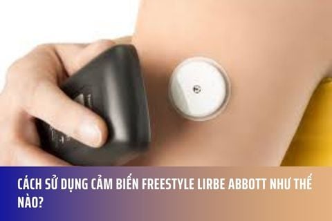 Cách sử dụng cảm biến Freestyle Lirbe Abbott như thế nào?