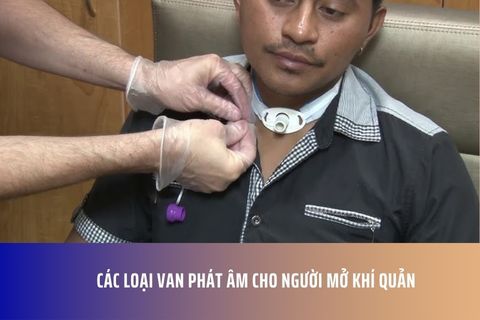 Các Loại Van Phát Âm Cho Người Mở Khí Quản