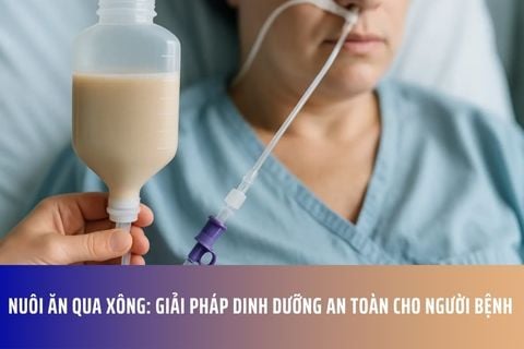 Nuôi Ăn Qua Xông: Giải Pháp Dinh Dưỡng An Toàn Cho Người Bệnh