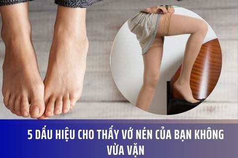5 Dấu Hiệu Cho Thấy Vớ Nén Của Bạn Không Vừa Vặn