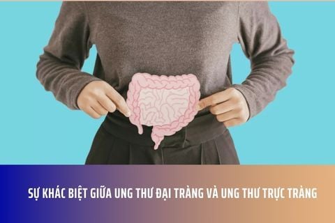 Sự khác biệt giữa ung thư đại tràng và ung thư trực tràng