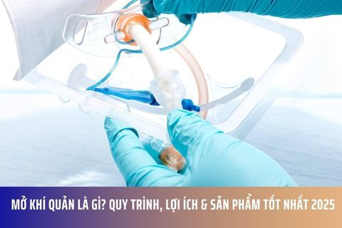 Mở Khí Quản Là Gì? Quy Trình, Lợi Ích & Sản Phẩm Tốt Nhất 2025