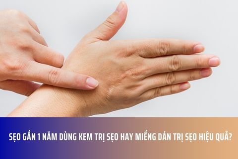 Sẹo gần 1 năm dùng kem trị sẹo hay miếng dán trị sẹo hiệu quả?