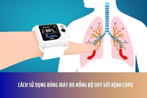 Cách sử dụng đúng máy đo nồng độ oxy với bệnh COPD