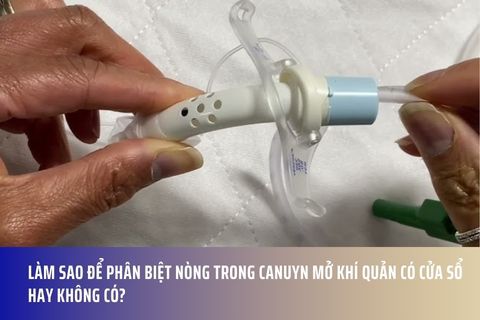 Làm sao để phân biệt nòng trong canuyn mở khí quản có cửa sổ hay không có?