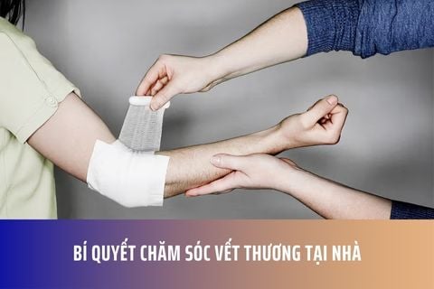 Bí Quyết Chăm Sóc Vết Thương Tại Nhà