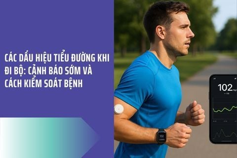 Các Dấu Hiệu Tiểu Đường Khi Đi Bộ: Cảnh Báo Sớm và Cách Kiểm Soát Bệnh