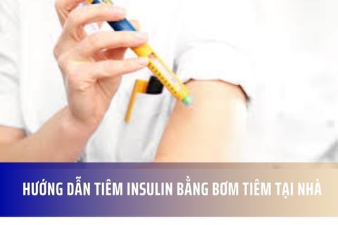 Hướng dẫn tiêm insulin bằng bơm tiêm tại nhà