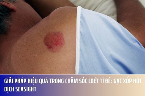 Giải Pháp Hiệu Quả Trong Chăm Sóc Loét Tì Đè: Gạc Xốp Hút Dịch Seasight