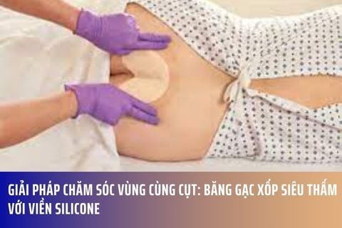Giải Pháp Chăm Sóc Vùng Cùng Cụt: Băng Gạc Xốp Siêu Thấm Với Viền Silicone