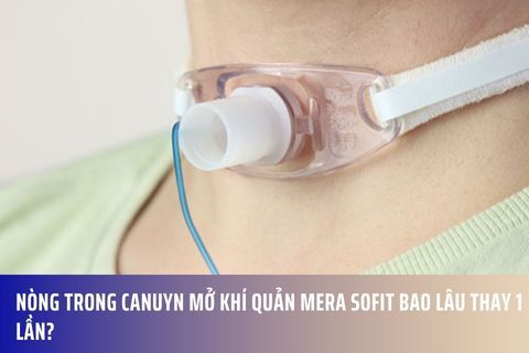 Nòng trong canuyn mở khí quản Mera Sofit bao lâu thay 1 lần?