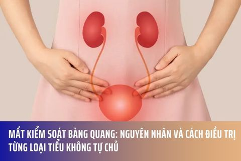 Mất Kiểm Soát Bàng Quang: Nguyên Nhân Và Cách Điều Trị Từng Loại Tiểu Không Tự Chủ