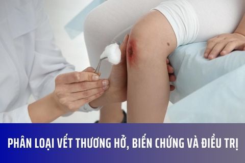 Phân loại vết thương hở, biến chứng và điều trị
