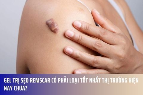 Gel trị sẹo RemScar có phải loại tốt nhất thị trường hiện nay chưa?