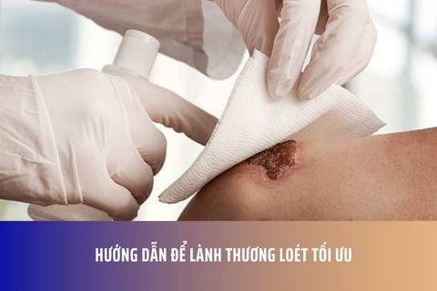 Hướng Dẫn Để Lành Thương Loét Tối Ưu