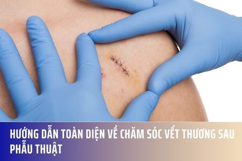 Hướng Dẫn Toàn Diện Về Chăm Sóc Vết Thương Sau Phẫu Thuật