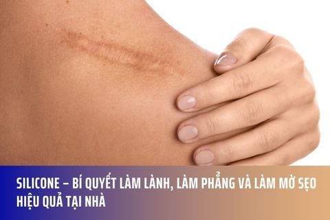 Silicone – Bí quyết làm lành, làm phẳng và làm mờ sẹo hiệu quả tại nhà