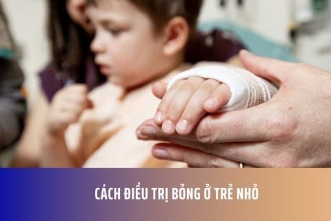 Cách điều trị bỏng ở trẻ nhỏ