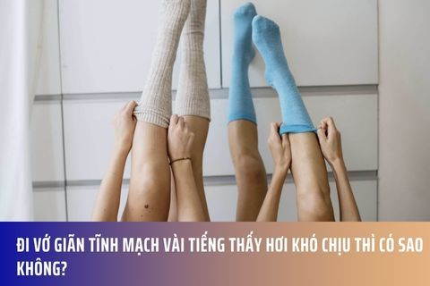 Đi vớ giãn tĩnh mạch vài tiếng thấy hơi khó chịu thì có sao không?
