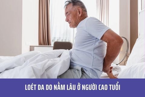 Loét da do nằm lâu ở người cao tuổi