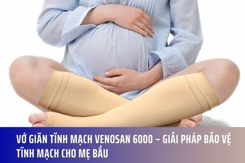 Vớ Giãn Tĩnh Mạch Venosan 6000 – Giải Pháp Bảo Vệ Tĩnh Mạch Cho Mẹ Bầu