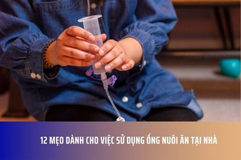 12 Mẹo Dành Cho Việc Sử Dụng Ống Nuôi Ăn Tại Nhà