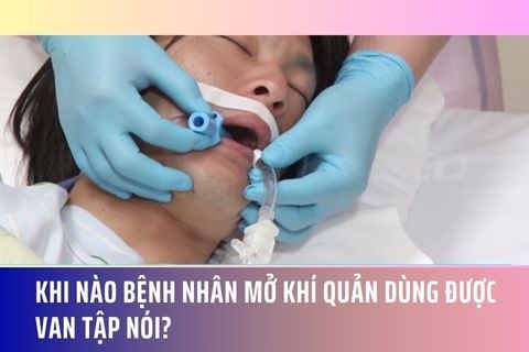 Khi nào bệnh nhân mở khí quản dùng được van tập nói?