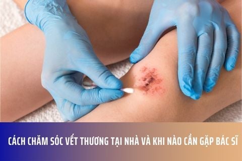 Cách Chăm Sóc Vết Thương Tại Nhà và Khi Nào Cần Gặp Bác Sĩ