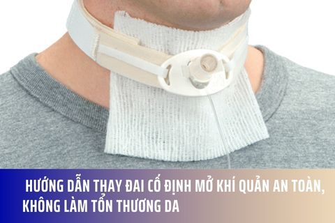 Hướng dẫn thay đai cố định mở khí quản an toàn, không làm tổn thương da
