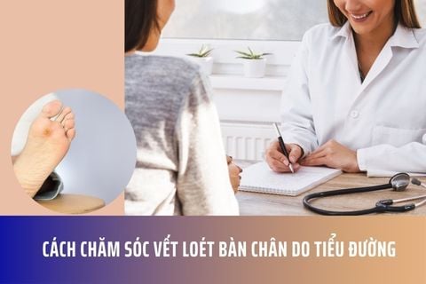 Cách Chăm Sóc Vết Loét Bàn Chân Do Tiểu Đường