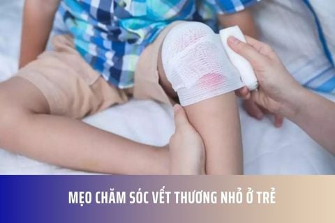 Mẹo Chăm Sóc Vết Thương Nhỏ Ở Trẻ