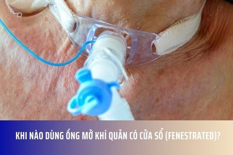 Khi nào dùng ống mở khí quản có cửa sổ (fenestrated)?