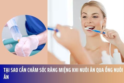Tại Sao Cần Chăm Sóc Răng Miệng Khi Nuôi Ăn Qua Ống Nuôi Ăn