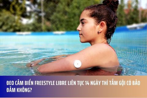Đeo cảm biến Freestyle Libre liên tục 14 ngày thì tắm gội có bảo đảm không?