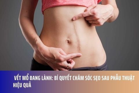 Vết Mổ Đang Lành: Bí Quyết Chăm Sóc Sẹo Sau Phẫu Thuật Hiệu Quả