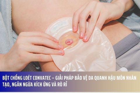 Bột chống loét convatec – Giải pháp bảo vệ da quanh hậu môn nhân tạo, ngăn ngừa kích ứng và rò rỉ