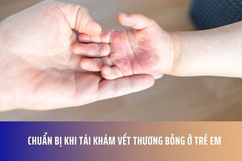 Chuẩn bị khi tái khám vết thương bỏng ở trẻ em